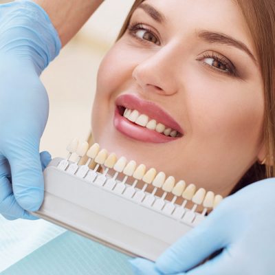 Clareamento dental: um tratamento fácil e prático