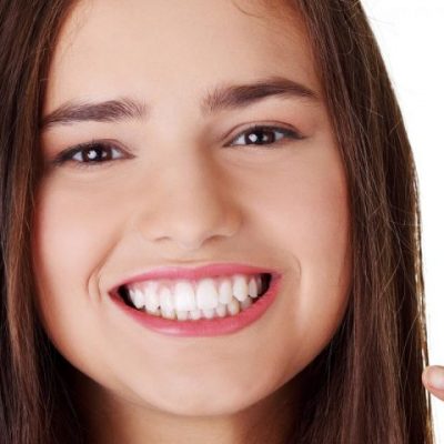 Saúde bucal na adolescência: como ter um sorriso bonito sem preocupações